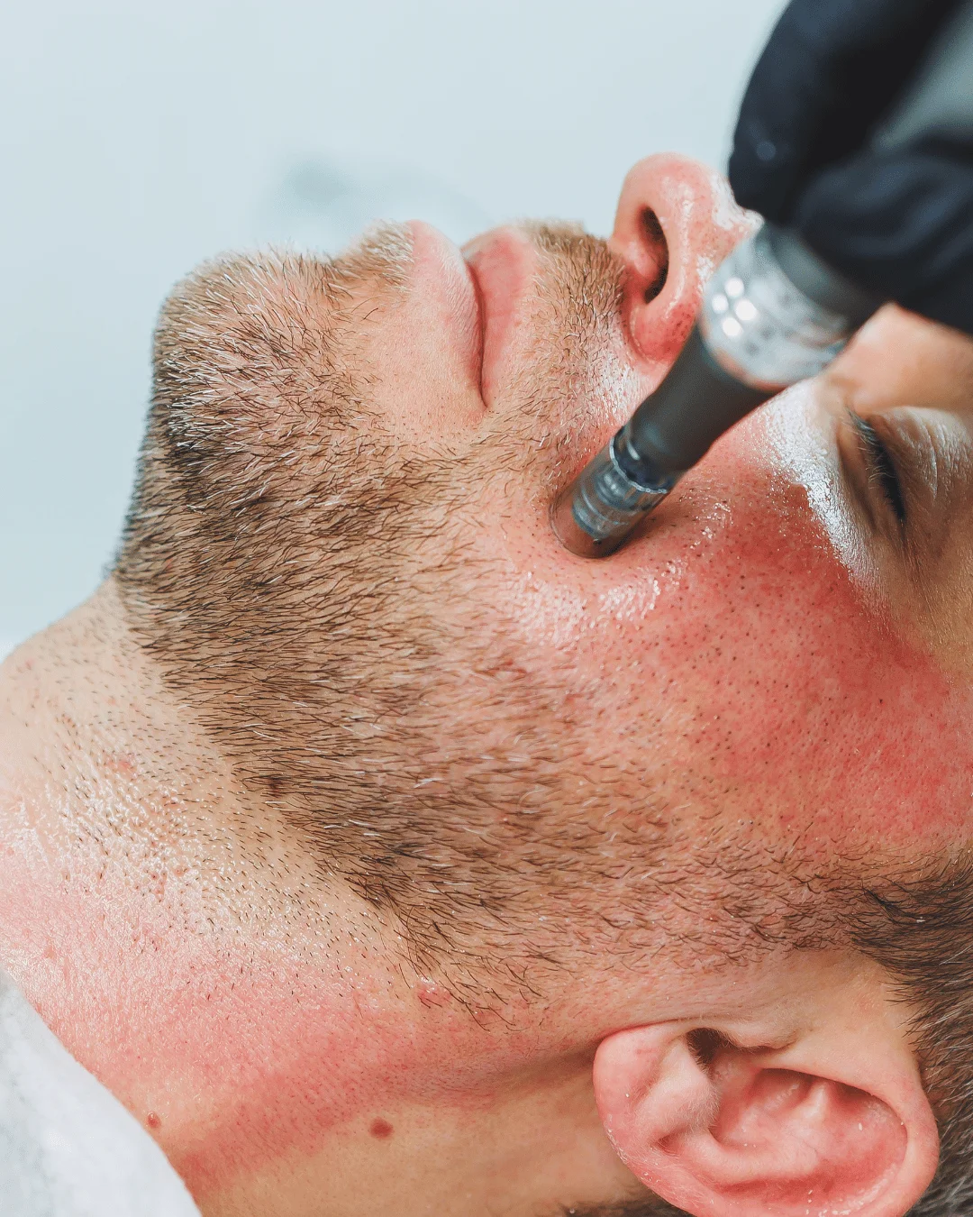 Гигиеническая чистка лица и вариант с поверхностным пилингом: для пор, чёрных точек и неровного рельефа. Запишитесь онлайн.