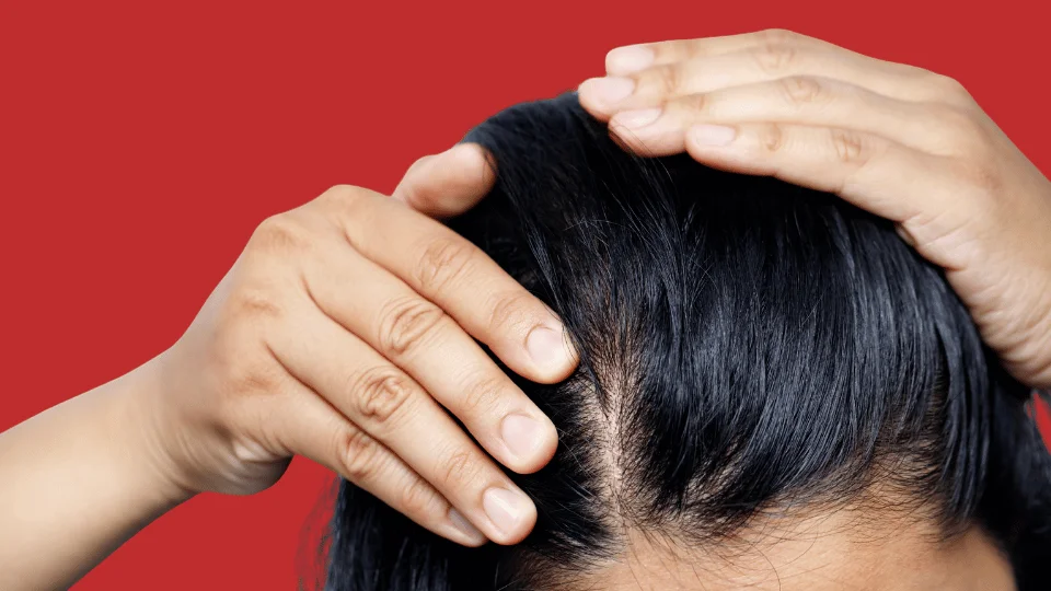 Диффузное выпадение волос в Астане: как остановить, сколько стоит лечение в Tulip Medicine и какие процедуры выбрать по результатам диагностики.