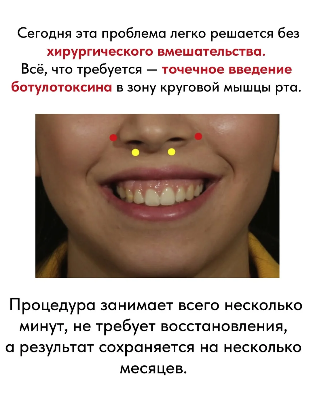 Коррекция гингивальной улыбки в Астане в Tulip Medicine: консультация врача, индивидуальный подход и эстетичный результат без лишней мимической перегрузки.