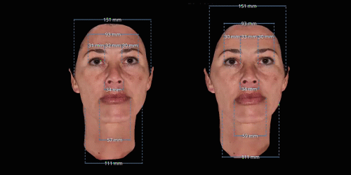 LifeViz Mini в Астане — 3D-анализ кожи в Tulip Medicine