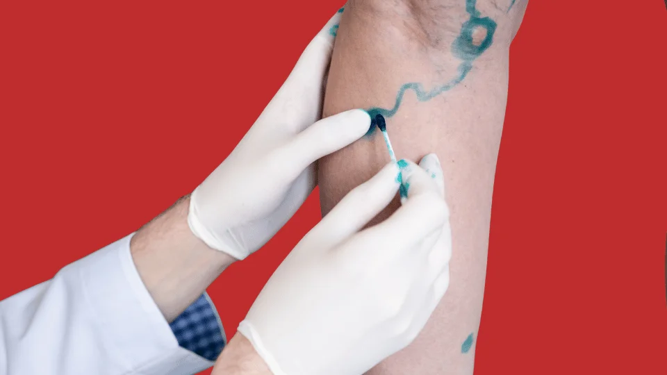 ангиохирург в Астане: диагностика, УЗИ вен, лечение варикоза и сосудистых звездочек в Tulip Medicine.