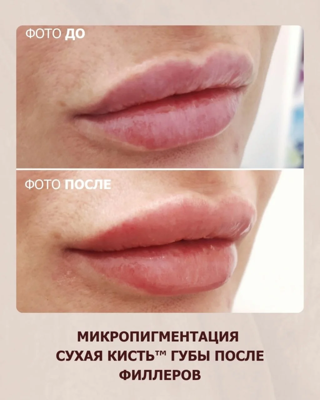 Микропигментация губ в Астане: техника «Сухая кисть», эффект и цена 3 Естественная микропигментация губ в Астане без эффекта плотной помады. Цена техники «Сухая кисть», показания, заживление и результат.