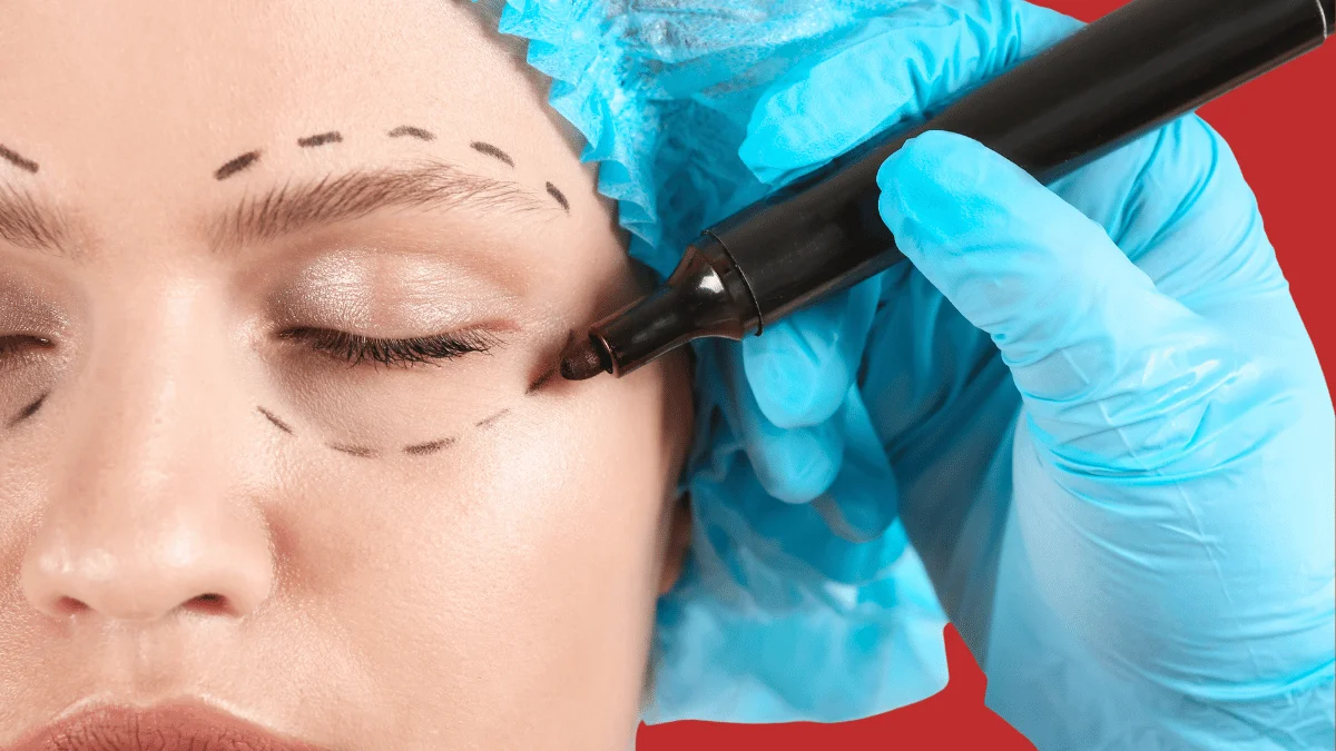 Блефаропластика Астана: верхняя, нижняя и трансконъюнктивальная — чем отличаются методы, кому подходят, сколько стоит и какой результат реально ожидать.