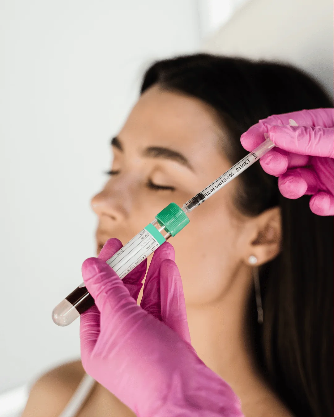 Плазмотерапия в Астане — что и для чего используют PRP-терапию, цена 2 Современная PRP-терапия в Астане. Восстановите кожу и волосы при помощи собственной плазмы без побочных эффектов.