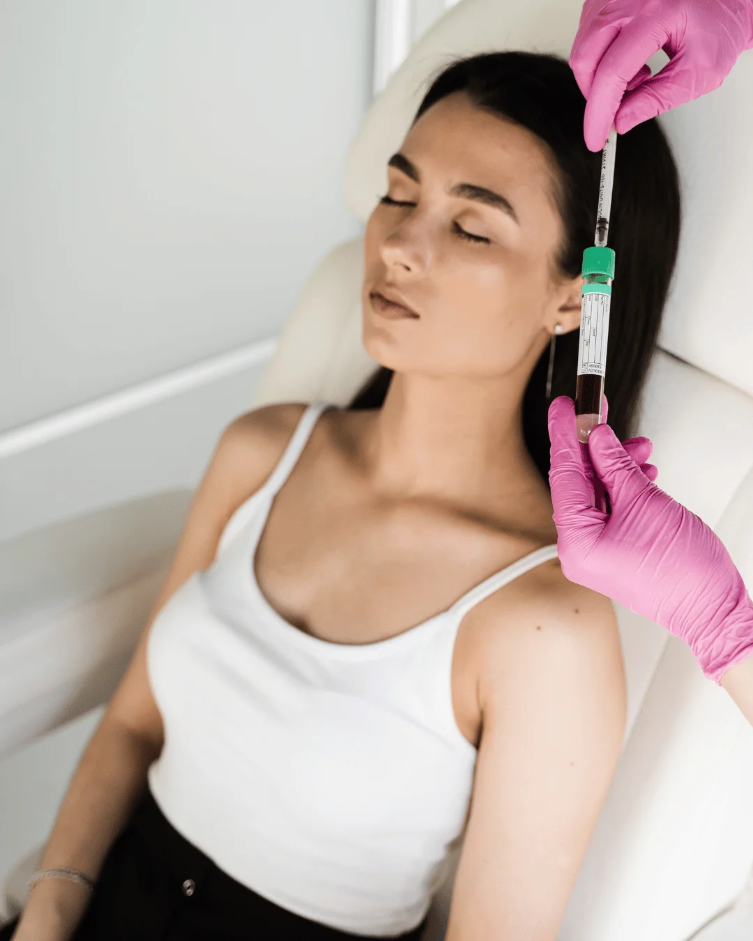 Плазмотерапия в Астане — что и для чего используют PRP-терапию, цена 1 Плазмотерапия в Астане — безопасный метод лечения акне, алопеции и возрастных изменений. Tulip Medicine, Астана.