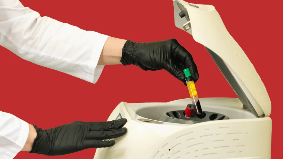 Плазмотерапия в Астане: лечение акне и алопеции, восстановление после процедур, упругая и чистая кожа.